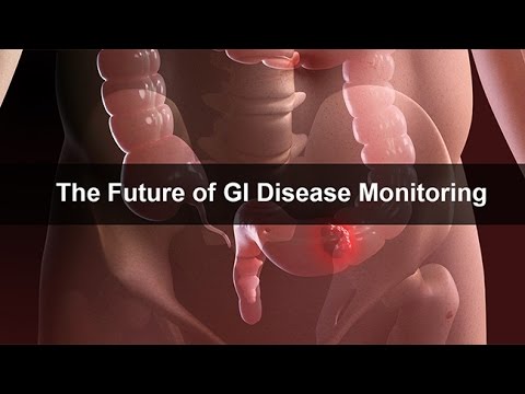 The Future of GI Disease Monitoring