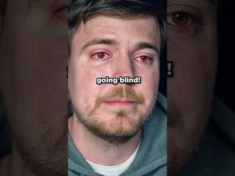 We Saved MrBeast From Going BLIND 😱
