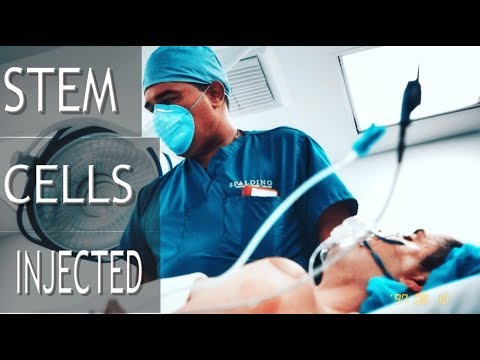 Stem Cell Surgery on Shoulder - Before and After