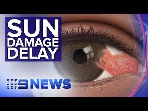 New drops could delay surgery for ‘Surfer’s Eye’ condition | Nine News Australia